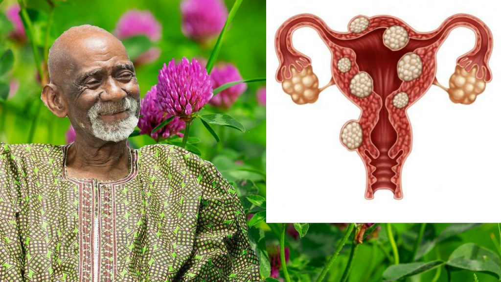 Endometriosis Dr Sebi