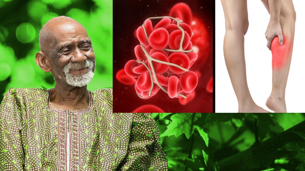 Blood Clots Dr Sebi