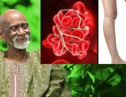 Blood Clots Dr Sebi
