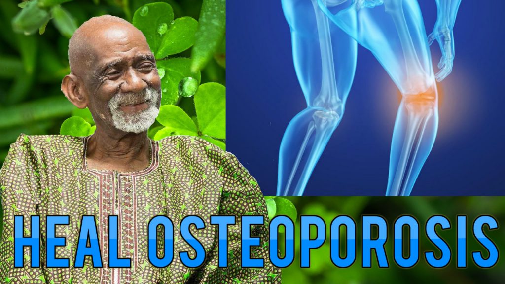 Osteoporosis Dr Sebi