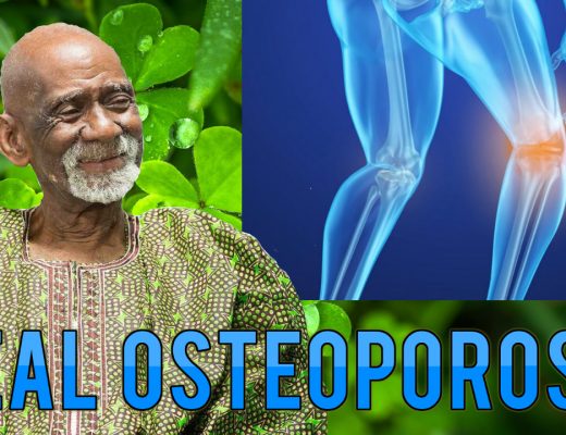 Osteoporosis Dr Sebi