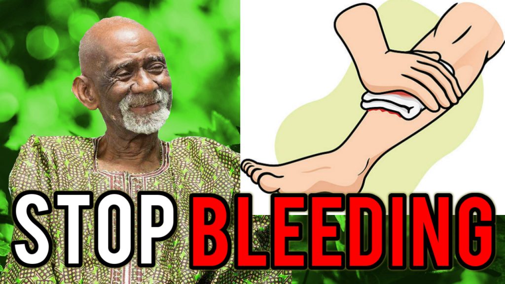 Bleeding Dr Sebi