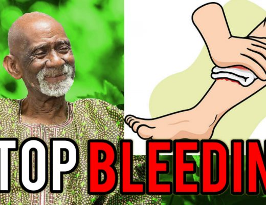 Bleeding Dr Sebi